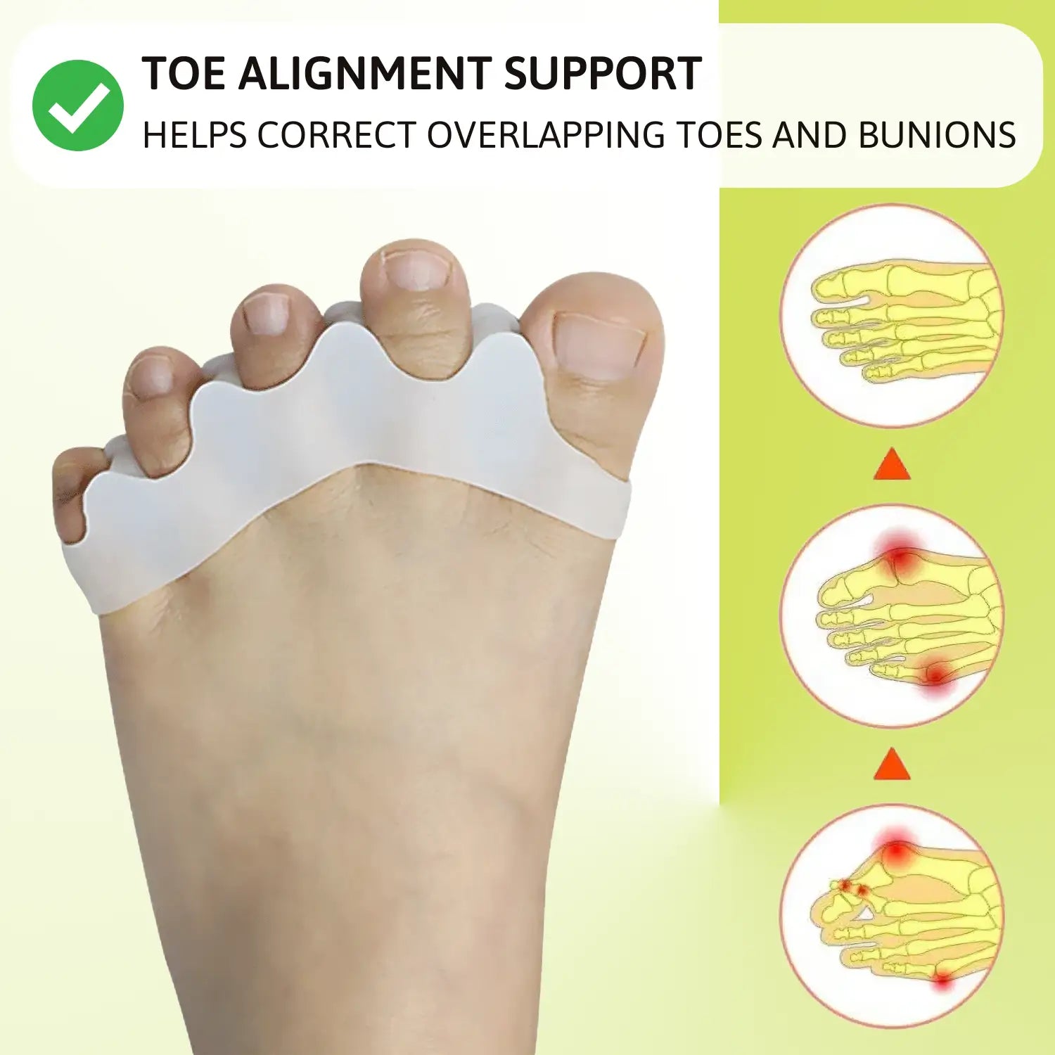 Concept Care | Toe Separator